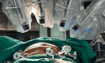 Robotic hysterectomy for benign gynaecological conditions