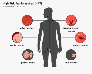 Human Papilomavirus