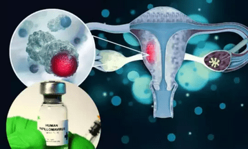 Lifesaving Vaccine to Prevent Cervical Cancer