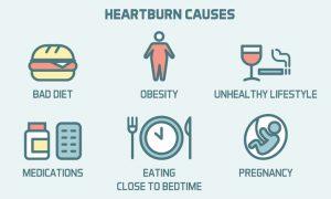 Causes of GERD