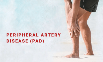 PERIPHERAL ARTERIAL DISEASE (PAD)