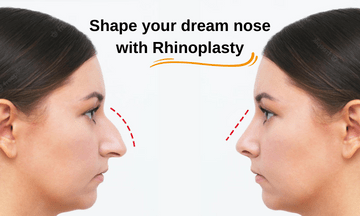 Shape your dream nose with Rhinoplasty