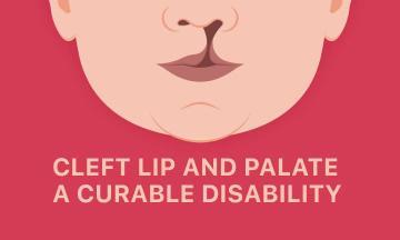 CLEFT LIP AND PALATE: A CURABLE DISABILITY