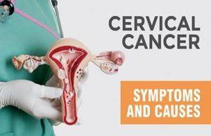 Cervical Cancer_Symptoms & Causes