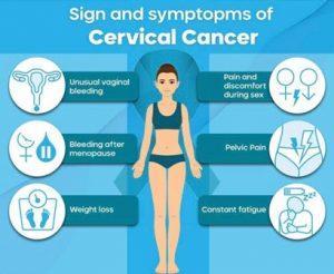 Signs & Symptoms of Cervical Cancer