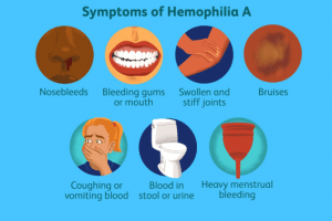Symptoms of Hemophilia
