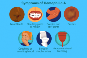 Hemophilia | MS Ramaiah Memorial Hospital