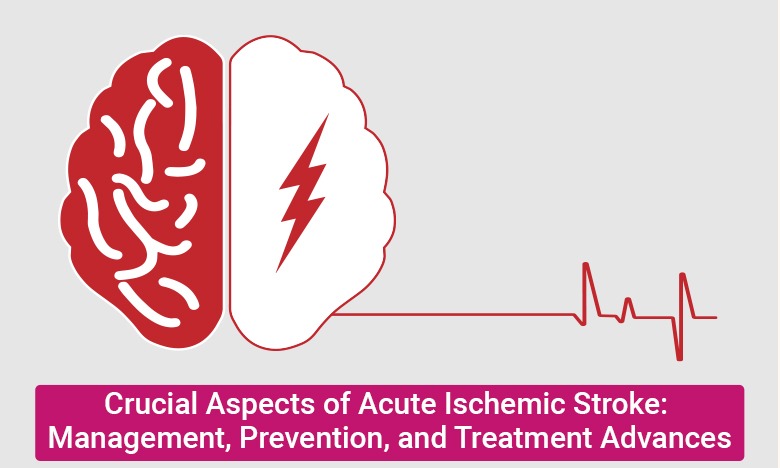 Crucial Aspects of Acute Ischemic Stroke: Management, Prevention, and Treatment Advances